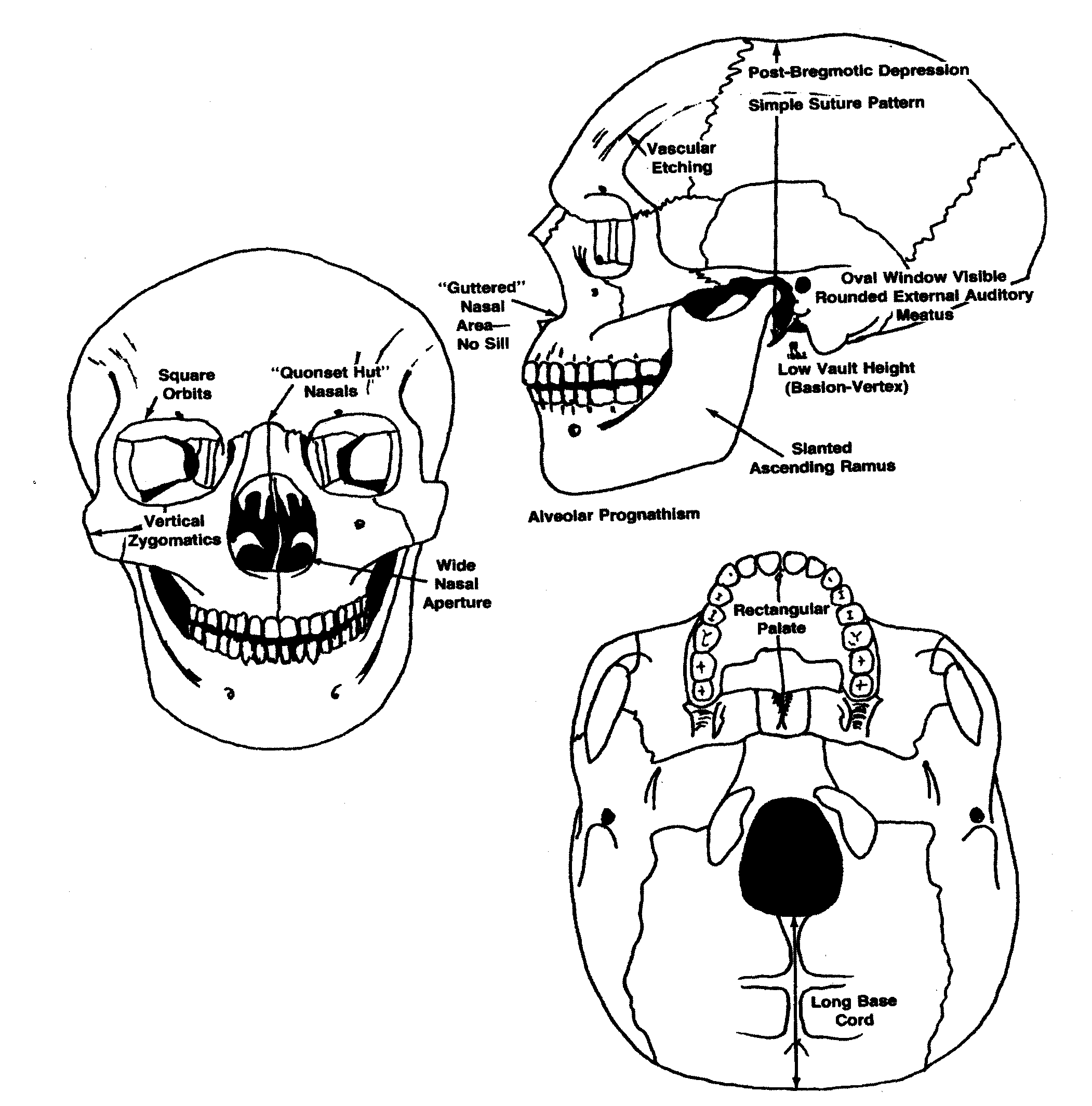 negroid skull