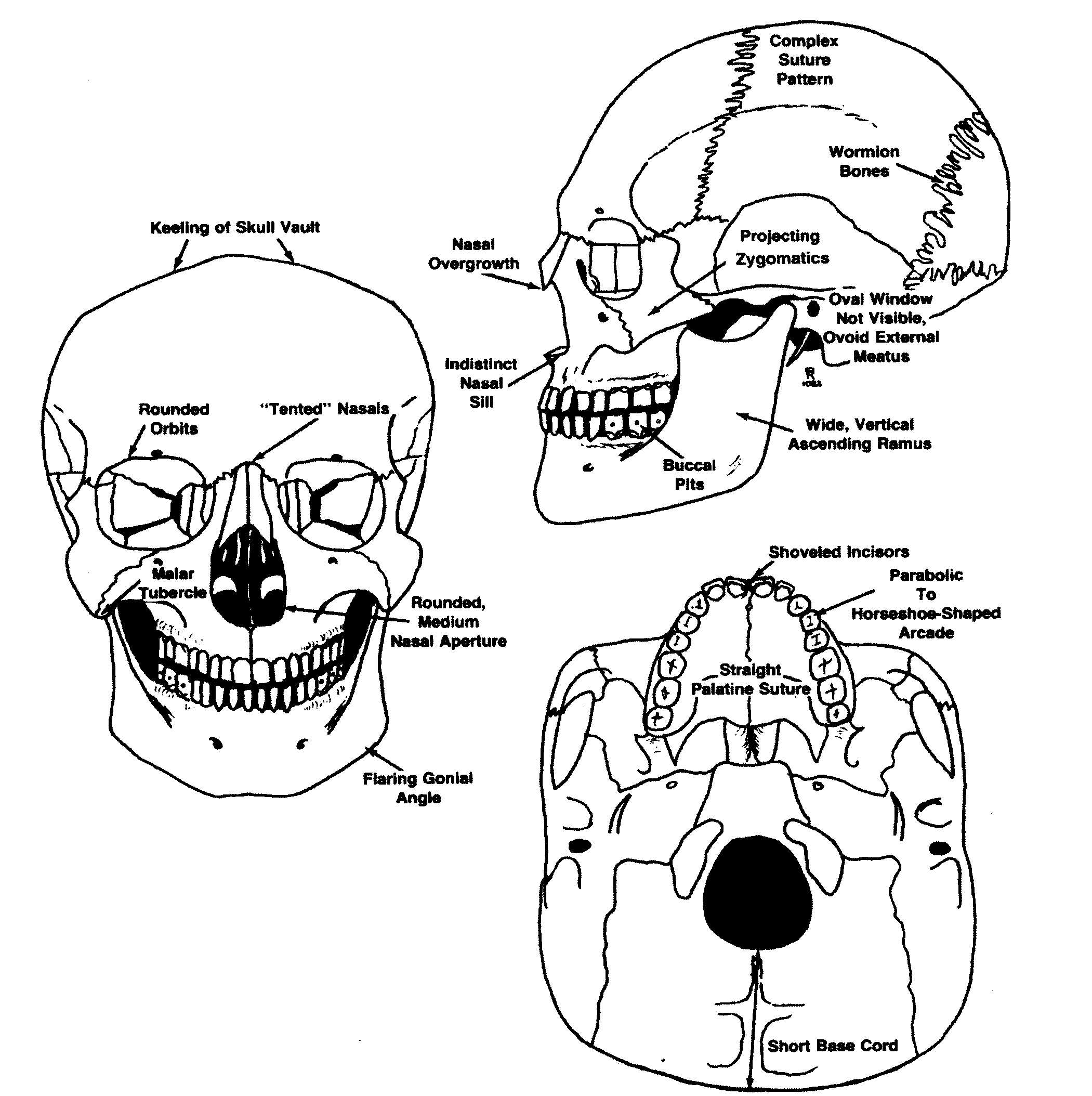 mongoloid skull