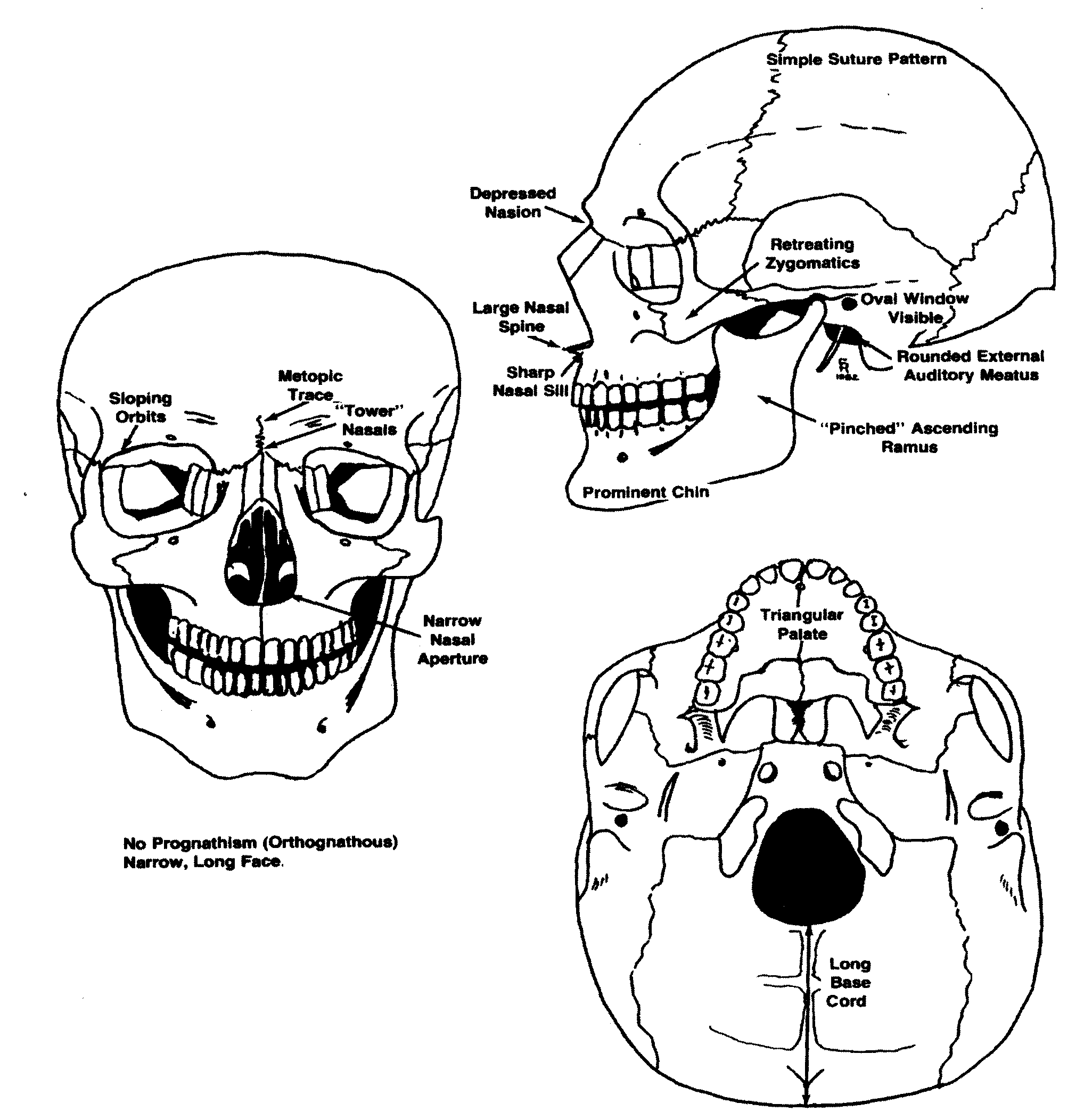 caucasoid skull