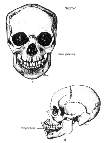 skull prognathism negroid shape difference differences race mongoloid caucasoid racial african shapes skulls forensic wku human different jew spot anthropometry