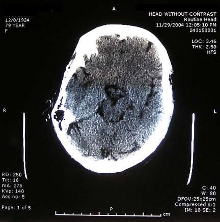 CT Scans from 11/29/04